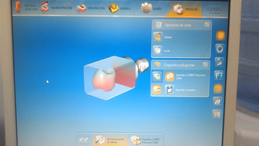 cerec bluecam cannot advance from model stage